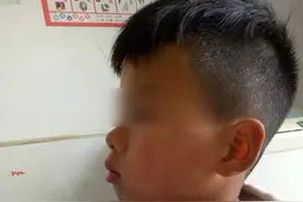 男孩越长越像“猩猩”，妈妈带去检查，医生的回答让妈妈自责不已图片