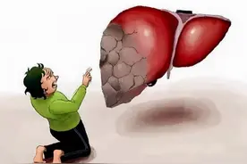 肝硬化需要的“有效护理”，你真的知道吗？图片