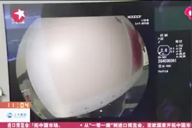 日本富士携转型成果亮相进博会，带来最新胶片激光内窥镜视频封面