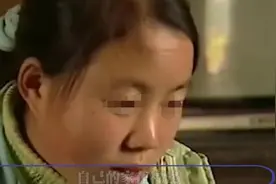 贵州少女晕倒后醒来，连口音都变了图片