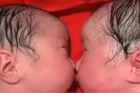 龙凤胎刚刚出生，哥哥就夺走了妹妹的"初吻"，旁边的护士都笑了图片