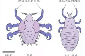过去农村常见的蛔虫、虱子，跳蚤，为什么现在都不见了？图片