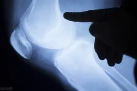 怪病缠身，52岁女老板像被“诅咒”一样，被两种罕见致病菌侵犯，只因一次旅行图片