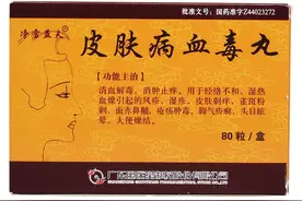 皮肤病血毒丸图片