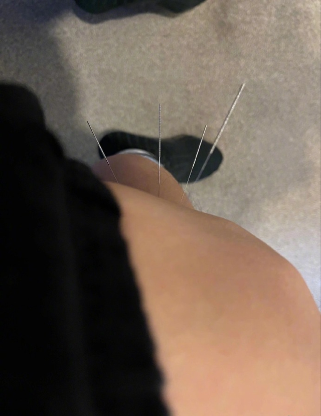 浑身疼起鸡皮疙瘩怎么了