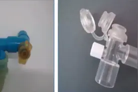 小儿气道手术的常见病例分享图片