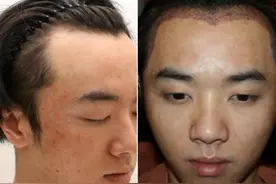 华晨宇被曝植发整容，十年容貌变化对比，锥子脸五官越来越精致图片