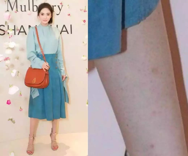 女生身上鸡皮肤好吗