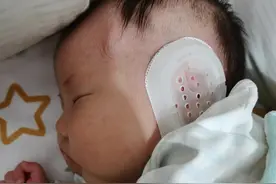 然然矫正耳朵图片