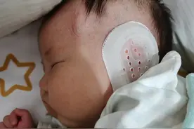 然然矫正耳朵图片