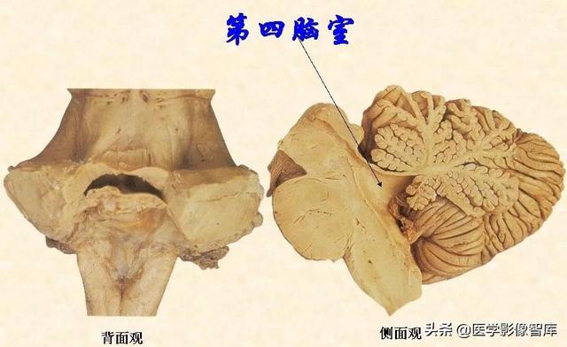 脑干、小脑及间脑解剖