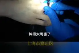 惊呆了！名牌戒指卡住手指，消防一说剪戒指，女子转身就要走……图片