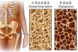 武汉市普仁医院康复科门诊开展“九九重阳 健康体查在普仁”活动图片
