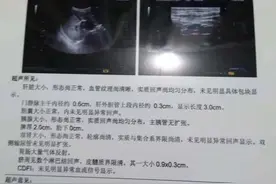 小儿腹痛，警惕肠系膜淋巴结炎图片