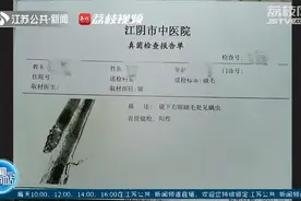 可怕！女子种睫毛引起眼部螨虫感染图片