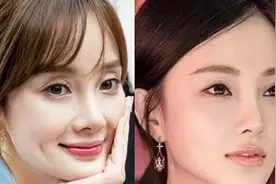 割的双眼皮会不自然吗？为什么景甜戚薇的双眼皮那么“霸气”！图片