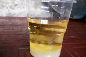 晨起尿黄，是肾病发出的信号？医生：要小心的，是这2种尿色改变图片