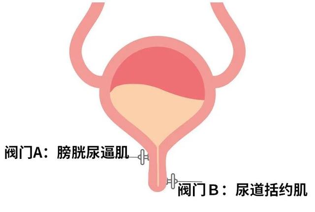 打喷嚏漏尿，是女性的必经之路？