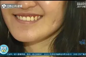 两边脸不对称，罕见半侧颜面短小症 南京女子20年两次手术盼“蜕变”图片