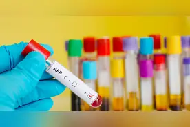 我甲胎蛋白升到了30，是不是肝癌啊？医生：先别吓唬自己图片