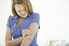 越痒越挠、越挠越痒、越挠越急？神经性皮炎犯了，先别瞎搔抓图片