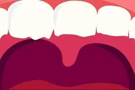 人体最「坚硬」的部位，是怎么被磨坏的？图片