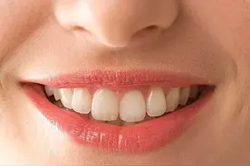 关于满分微笑的两条“标准线”，你符合吗？图片