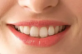 关于满分微笑的两条“标准线”，你符合吗？图片