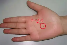 身体出现这样的痣，可能是癌细胞“在试探”，快看你有没有图片