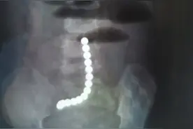 六一给孩子买什么礼物呢？专家提醒这个玩具应严格禁止儿童接触图片