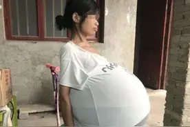 女子肚子2年时间长成球，每晚只能坐着睡觉，记者前去采访图片