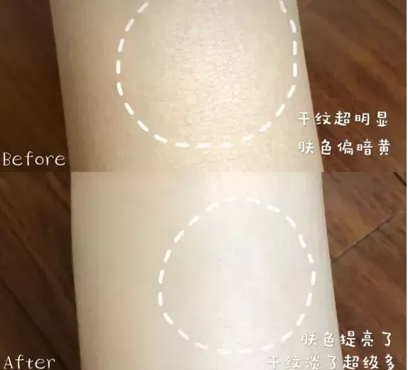 后背有痘能用身体乳吗