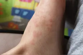 我与斯蒂尔综合症（一）图片