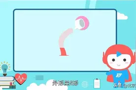 无创通气管道——口咽通气道图片