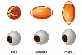 【爱眼护眼84】“散光”的理解图片