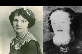 1921年，女孩们身体溃烂、尸骨发光，却被美国公司诬陷为身患梅毒图片