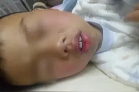 儿子越长越像“大猩猩”，妈妈带去做检查，医生的话让她无地自容图片