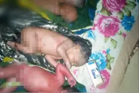 非洲30岁女子已是12个孩子的母亲，如今她又在家中生下4胞胎图片