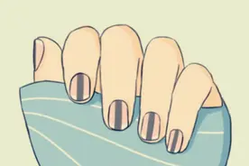 手指甲的一条黑线没在意，演变成黑色素瘤，坎坷的抗癌之路图片