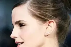 嘴型和下巴是面部的焦点，一个简单的方法判断自己牙齿有没有外凸图片
