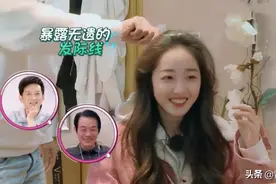 明星原来是这样治秃的，蒋梦婕成第一个敢在镜头前植发的女明星图片