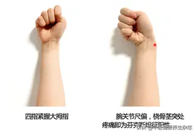 提重物、抱孩子，手腕疼痛难忍？几个小动作，帮你检测“妈妈手”图片
