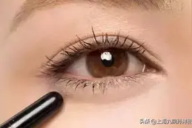 孙沣博士：双眼皮手术后，眼睛总爱流泪是正常情况吗？图片