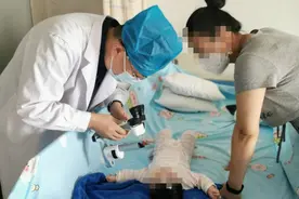 福建3个月大女婴天生没瞳孔，竟是这个病！孩子出生要注意图片