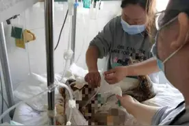 男子泼汽油烧女友致其大面积烧伤 律师：行为恶劣，涉嫌构成故意伤害罪图片