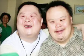 为什么唐氏综合征患者，几乎都长的一模一样呢？原因让人心酸！视频封面