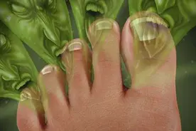 一通操作猛于虎，结果治疗全没谱！教你3招，治疗脚气不复发图片