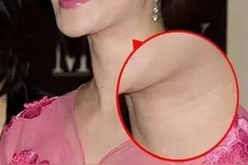 脖子出现“三道杠”的女人，要注意了，这东西正在慢慢靠近你图片