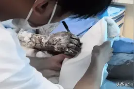 揪心！用水泼油锅，夫妻俩被烧成重伤，当场休克！图片