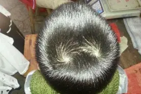 “一个旋愣、两个旋横、三个旋不要惹”，娃头上的“旋”你懂哪些图片